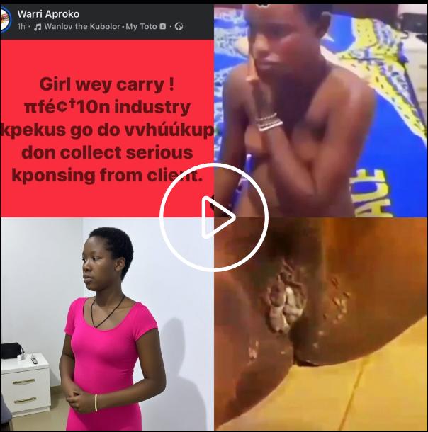 Hookup Girl with infection pussy gets exposed by naija boys